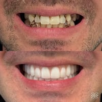 مركز ماسة الحسينية التخصصي لطب وجراحة الفم والأسنان   ابتسامة قوية وصح...