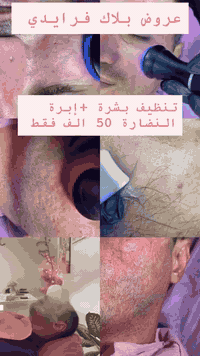 عيادات الرحمة الطبية 
قسم التجميل و الليزر 

مجمع بسمايه السكني -مقابل البوابة الجديدة بناية كوفي حنوش الطابق الأرضي 
للحجز ***********
@إشارة
