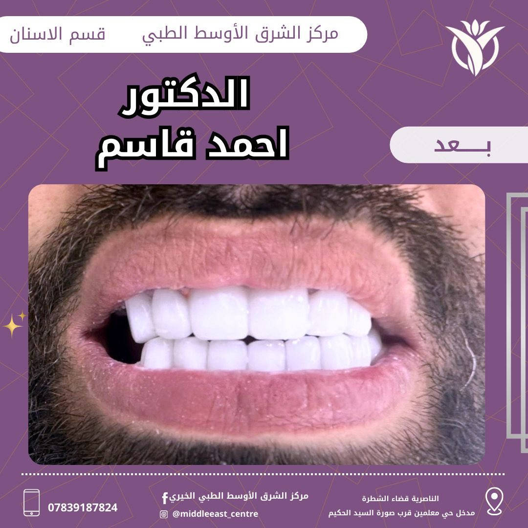 تركيب الأسنان الدكتور احمد قاسم

📍مركز الشرق الاوسط الطبي قضاء الشطرة مدخل حي معلمين قرب صورة الحكيم

⏰اوقات الدوام في شهر رمضان المبارك
صباحاً من الساعة 8:00 والى 12:00ظهراً
ومساءاً من الساعة 2:30 والى 5:30 قبل الافطار
‎ومن 8:00 بعد الأفطار والى 11:00 ليلاً

☎️الاستفسار الاتصال او المرسلة على الواتساب ***********
