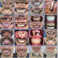 النجف الأشرف • تجميل أسنان • عيادة الزهيري