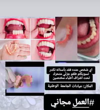 قلع جذور الاسنان • مجاناً • عيادات الجامعه الوطنيه ذي قار