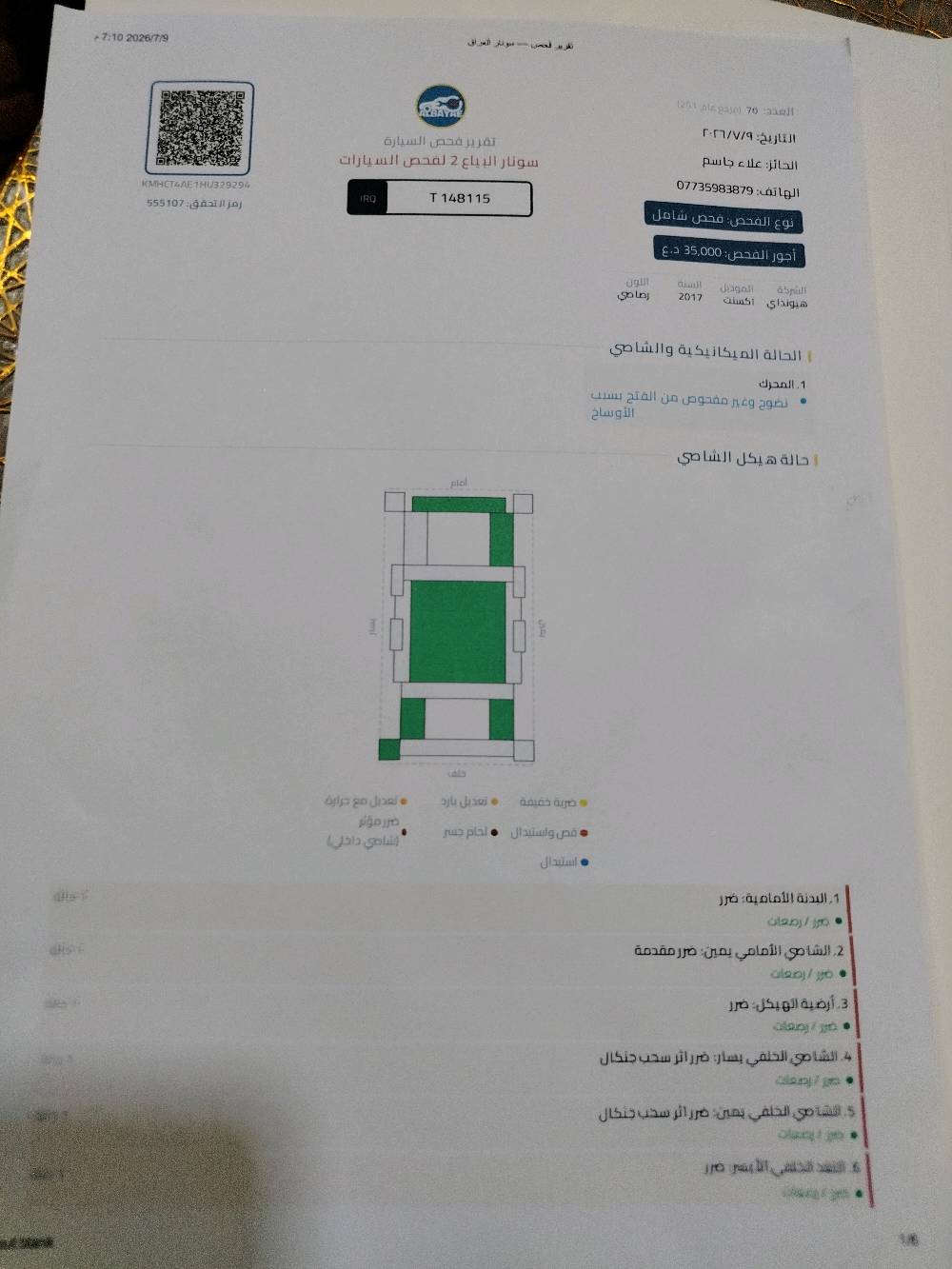 السلام عليكم
اكسنت 2017   وارد أمريكي للبيع
السياره محرك 2000GDI ماشيه 69 
جاهزه وجيده جدا
السعر 100ورقه
بغداد اليرموك
***********
صور السونار مرفقه المحرك غير مفتوح ولا يوجد تبديل بالقطع الرئيسيه