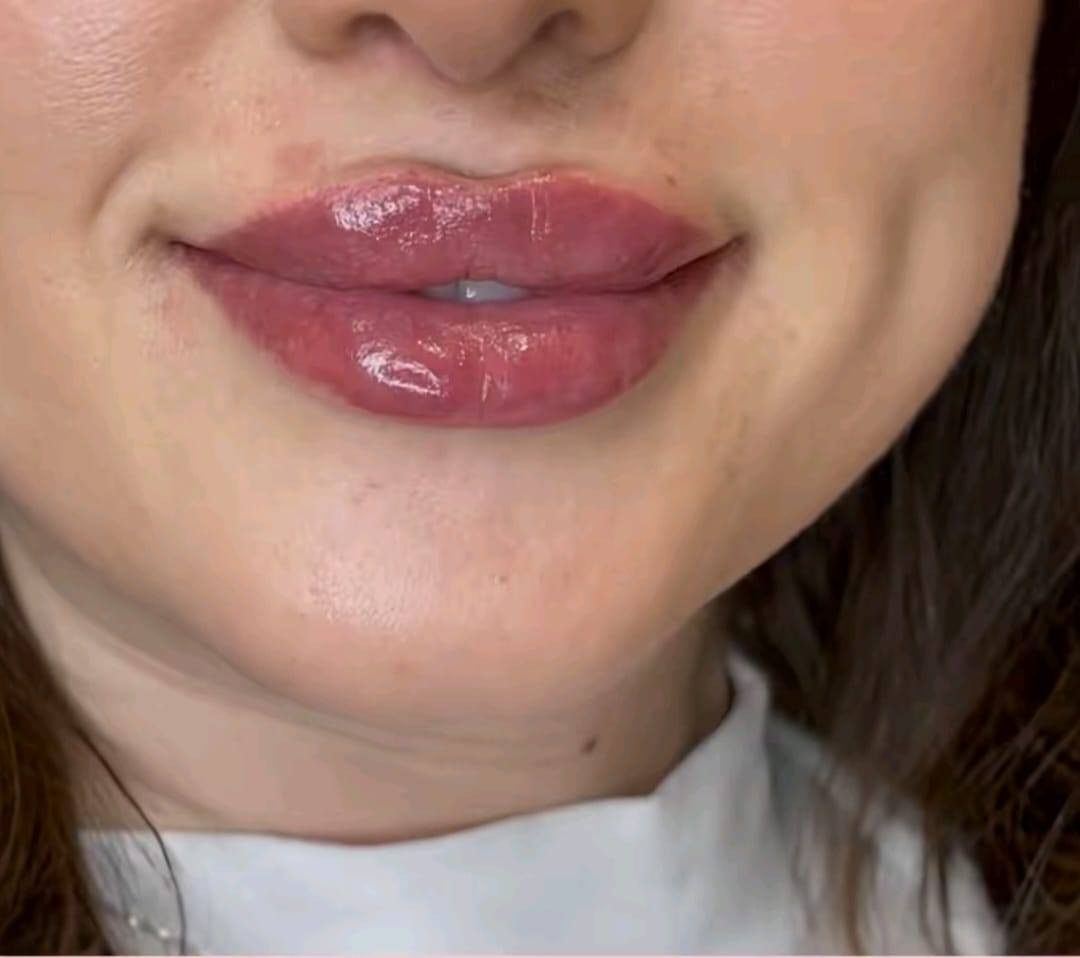 السيسي الواحد 25 الف
مدينة الصدر الكياره قطاع٦٧ مقابل نادي الجولان عيادة ايفا لتجميل الوجه والأسنان


**إذا كنت صاحب هذا الإعلان وتريد حذفه لأي سبب، رجاءا أرسل رسالة إلى الدعم الفني**