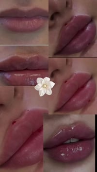 صالون وردهعروض  فيلر  45 🫶07775899499