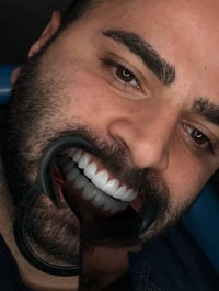"🦷 أسنان صحية وابتسامة مشرقة...  في مراكز الشركة الطبية العالمية ، نوف...