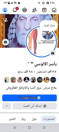 أنا معالج بالطب البديل اعالج مرض عرق النساالانزلاق الغظروفي علاج نهائي...