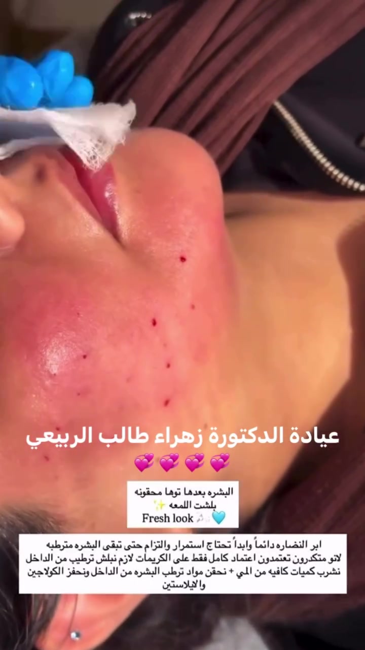 لكل بنات المسيب العروض حصرياً لفرع المسيب
حتى تستفادون منها خصوصا اذا اكو عروسات 🌸
كلش راح تستفادون من العروض لان وياها تنظيف بشرة مجاناً

#تنظيف البشرة بجهاز الهايدروفيشل والسنارة والبخار 🌸

لكثر الطلب على العروض سوينالكم هلمرة عروض غير 💓🌷

يرجى الحجز المسبق على رقم الواتساب مسجات فقط ***********💓👌🏻💐

عيادة الدكتورة زهراء طالب الربيعي 
💓💐
