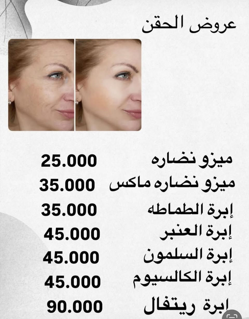 ✨ عروض مميزة من صالون الماكيرا نونة ✨
دللي نفسج ويانا بأحدث الخدمات 💄

🔥 خصومات خاصة لفترة محدودة

📍 الحجز مفتوح الآن

📩 للحجز مراسلتنا على الخاص

 العنوان المشتل شارع المدارس قرب ياسر جكن ***********
