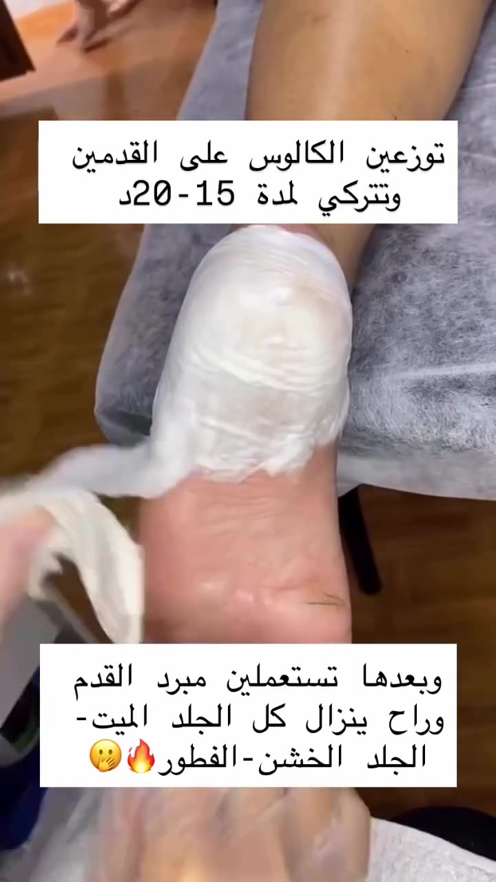 متوفر توصيل للمادة فقط لجميع المحافظات
كالوس القدم الخاص بينا
يساعد على إزالة الجلد الخشن والكالو ويخلي القدم أنعم ومرتبة من أول استخدام

سهل الاستخدام ومناسب للعناية المنزلية

للحجز والاستفسار دايركت


**إذا كنت صاحب هذا الإعلان وتريد حذفه لأي سبب، رجاءا أرسل رسالة إلى الدعم الفني**