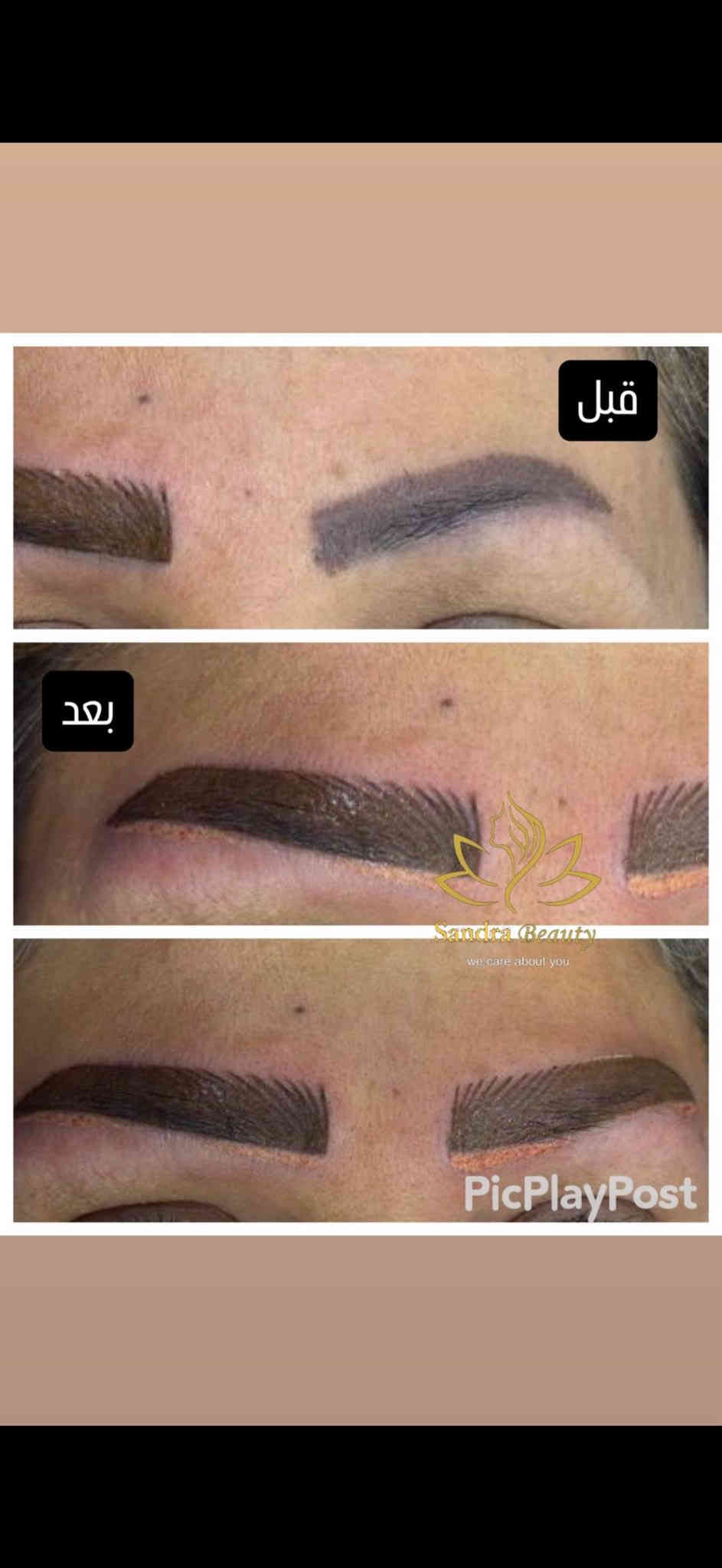 مساء الجمال 😍😍
بناء على طلبكم سوينالكم عروض
استغلو العطله ياحلوات ودللو نفسكم🤭
 وجددو طاقتكم🥰🥰

عروض ساندرا بيوتي😍🔥زبائني لحو علية 
اجدد العروض ويدللون علينا 🥰🥰🫶🏻🫶🏻💋
____________________________________يلة للمنتضرين العروض 
وكلساع يراسلون يردون العرض 
تعالو 🥰🥰🥰
🌿 
🌿

🪻عروووض قسم التاتو🍄🌺

🪷توريد شفايف مع تحديد 45 الف
🪷مسح حًواجب بالليزر 25 الجلسه
🌺مسح مادة لاحماض الفايبروز 35 بدل ال50 

🪷تحشا حواجب حاجب بلوك45

🪷فايبروز 120 الف بدلا من 150 

🪷مايكرو75 الف بدلا من 100 الف
🪷اومبرا مقدمه 3d ونهايه بلوك 55 بدلا من 
85 
🪷6d سعره60 الف بدلا من 95 الف
مع ضمان اللون بعد التقشير
استغلوو هالعروض🍁🍁🍁

________________________________
عنوان الجمال😍
#شعارنا_ضمان_النتائج✅
 😍وتدللون علينا
مده هالعروض فقط 5 ايام من اليوم 😍😍
🍁ملاحظه🌿🌿الي متكدر تشتغل بفتره العرض تقطع وصل بدفع المبلغ وبعدها ع راحتها شوكت ميعجبها نشتغلها بعد شهر وحتى شهرين🫣🐝
📍العنوان
الديوانيه / العروبه الاولى
 نهايه فرع  مثلجات حسين 
صالون ساندرا بيوتي 
☎️***********
☎️***********
