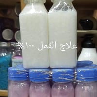 علاج قمل وصيبان • أعشاب طبيعية • توصيل قضاء بلد
