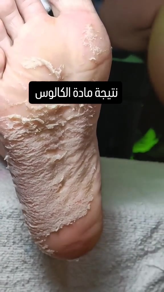 للحجز والاستفسار خاص


**إذا كنت صاحب هذا الإعلان وتريد حذفه لأي سبب، رجاءا أرسل رسالة إلى الدعم الفني**