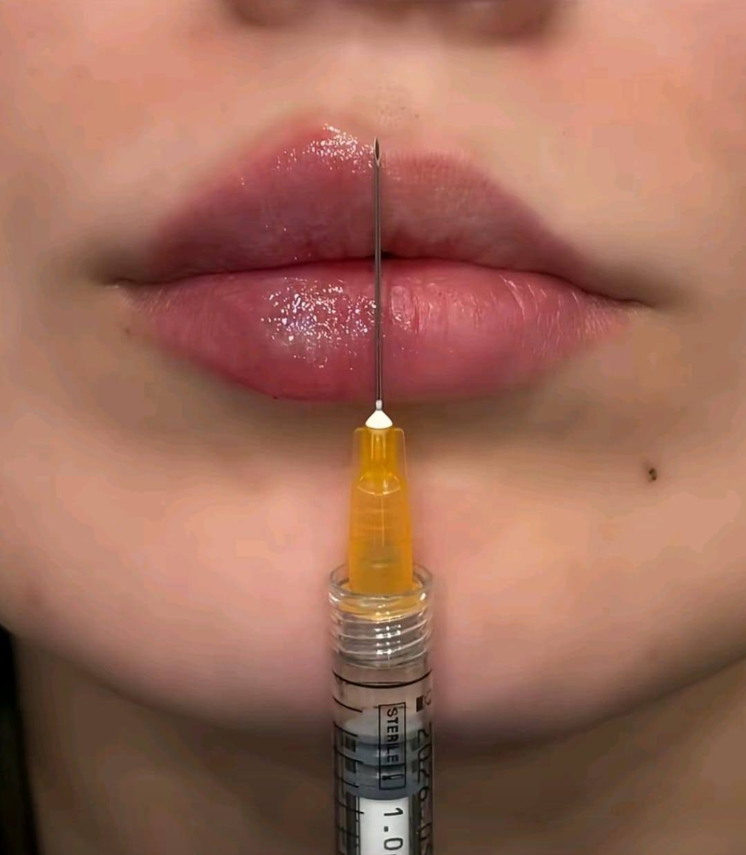 السيسي الواحد 25 الف
مدينة الصدر الكياره قطاع٦٧ مقابل نادي الجولان عيادة ايفا لتجميل الوجه والأسنان


**إذا كنت صاحب هذا الإعلان وتريد حذفه لأي سبب، رجاءا أرسل رسالة إلى الدعم الفني**