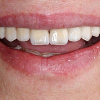 ابتسامة المشاهير لمراجعتنا العزيزة  الدكتور محمد حسن عقيل القريشي  للح...