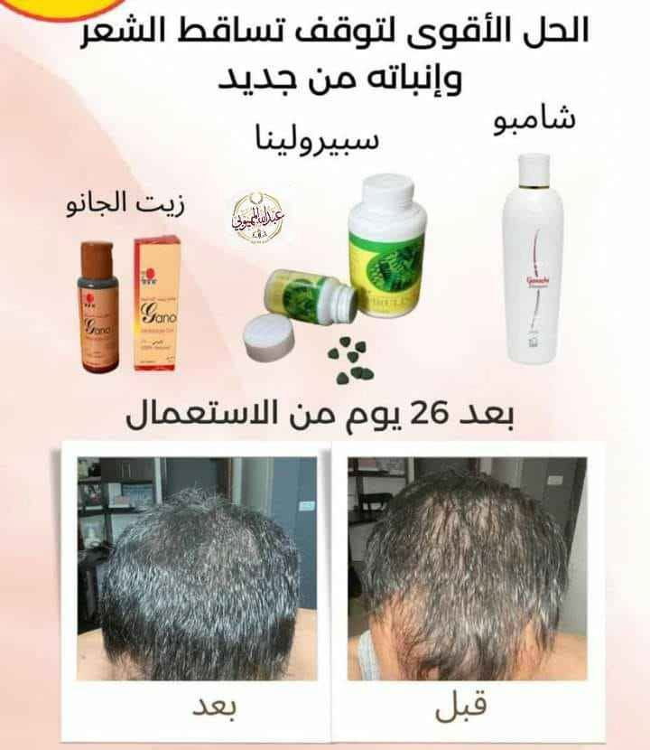 مكملات غذائيه طبيعيه %تساعد الجسم على التخلص من السموم والامراض المزمنه والالم المفاصل ومشاكل البشره يوجد توصيل حميع المحافضات 🥰🥰🥰🥰 كربلاء, العراق


**إذا كنت صاحب هذا الإعلان وتريد حذفه لأي سبب، رجاءا أرسل رسالة إلى الدعم الفني**