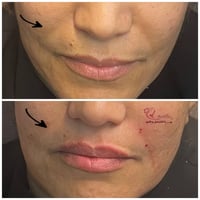 خطوط الضحك • عيادة تجميل • مجمع الكندي