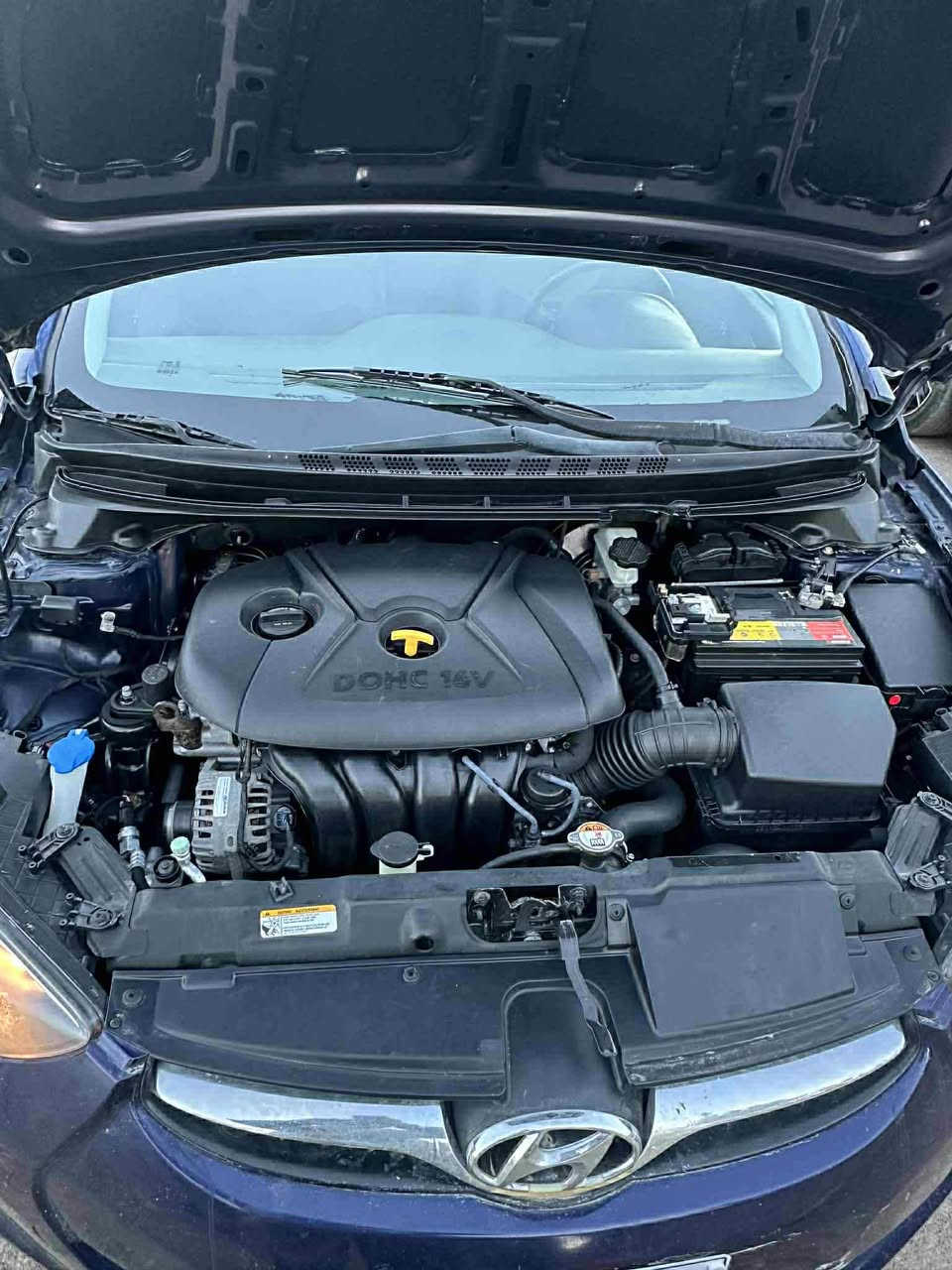 هۆندا ئەلێنترا ٢٠١٣ 
لێزەری دوبەی بڕاوەیە
فول مواسەفات 
سلآیت 
کوشن جڵد
ئیکۆ
تراکشن
تعدید سورحە
کوشن هیتەر 
کارەبای هەمووی بەشەرت 
سحری/٥٥$و مەجال
*********** أربيل, العراق
