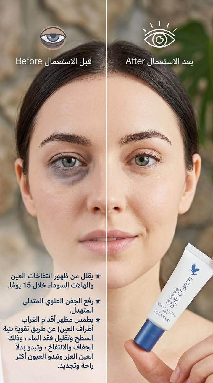 وداعاً للتعب والهالات.. وخلي عيونج تنبض بالحياة! 🌟
​لكل البنات اللي يعانن من السهر، التعب، والهالات المزعجة.. جبنالكم الحل السحري والنهائي من شركة فوريفير ليفينج العالمية! 💆‍♀️✨
​👁️ كريم awakening eye cream (كريم إيقاظ العين) 👁️
​هذا الكريم مو مجرد مرطب عادي، هذا معجزة صغيرة راح تغير إطلالتج بـ 15 يوم بس! 😉👇
​💫 شنو اللي راح يسويه لعيونج؟
​🔴 يقلل بشكل ملحوظ من الهالات السوداء والانتفاخات تحت العين.
​🔴 يرفع الجفن العلوي المترهل وينطي لعيونج نظرة واسعة ومصحصحة.
​🔴 يطمس تجاعيد أطراف العين (أقدام الغراب) ويقوي بنية البشرة حول العين.
​🔴 يرطب بعمق ويحمي المنطقة من الجفاف حتى تبقين دايماً بشكل أصغر وأكثر حيوية.
​💰 التفاصيل والطلب:
​🚨 الكمية جدًا محدودة! لا تترددين واحجزي قطعتج هسة قبل ما تخلص الكمية وتفوتج الفرصة! 🛒💨
​💌 للطلب أو الاستفسار، راسلينا على الخاص مباشرةً 💌#عناية_بالشعر #بغداد_بصرة_موصل_الكويت_الخليج_دبي_الامارات_السعودية_العراق_حلوات_لبنان_سوريا_فلسطين #عنايه_شخصيه_للجسم_جل_استحمام_كريمات_تفتيح_المناطق_الحساسه_ترطيب👌🏻👌🏻👌🏻❤️❤️❤️ #عنايةبالبشرة #عناية_أنثوية


**إذا كنت صاحب هذا الإعلان وتريد حذفه لأي سبب، رجاءا أرسل رسالة إلى الدعم الفني**