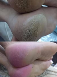 منتجات القدم • ٤٩ قطعة • للصالونات