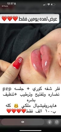 خدمات • عروضنه غير