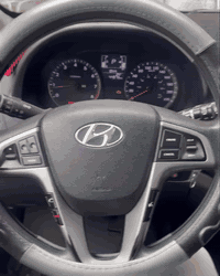 🚗⚠️ أعطال ستيرن الأكسنت المضلّع – حركة وحدها ورجّة قوية!  إذا سيارتك أ...