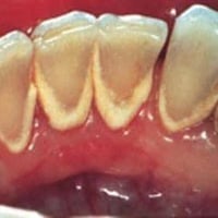 تنظيف تكلسات • مجاناً • كربلاء