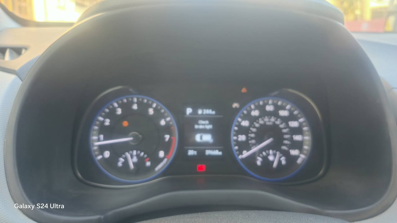 هونداي كونا 2021
محرك 2000 كير at
سياره فول ما عده فتحه 
حادث كما موضح بالصور 
سعر 133
ستفسار ***********
