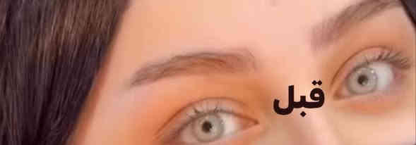 السلام عليكم بنات تخفيض المدة اسبوـع 35 فايبروز
#وتساب الحجز/***********
