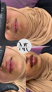 07765219099 البياع تقاطع الشرطه الرابعه يم مطعم السديل