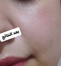 تصفية بشرة • كريم ليلي • غسول بشرة