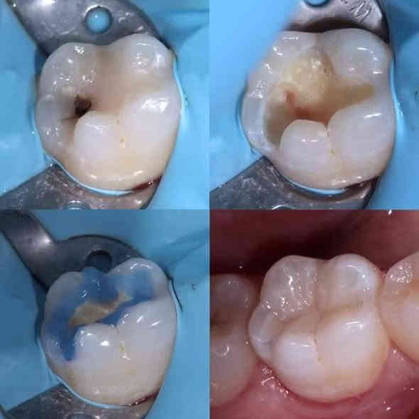 ((العلاج مجاني)) عيادات الجامعة الاسلامية لطب الاسنان
قلع الاسنان 
تنضيف الاسنان 
حشوات دائمية 
حشوات الاطفال 
طقم اسنان 
تقويم الاسنان 
للاستفسار مراسلتنا على الواتساب ***********
العنوان الميدينة القديمة مقابل عمارة الجيلاوي
