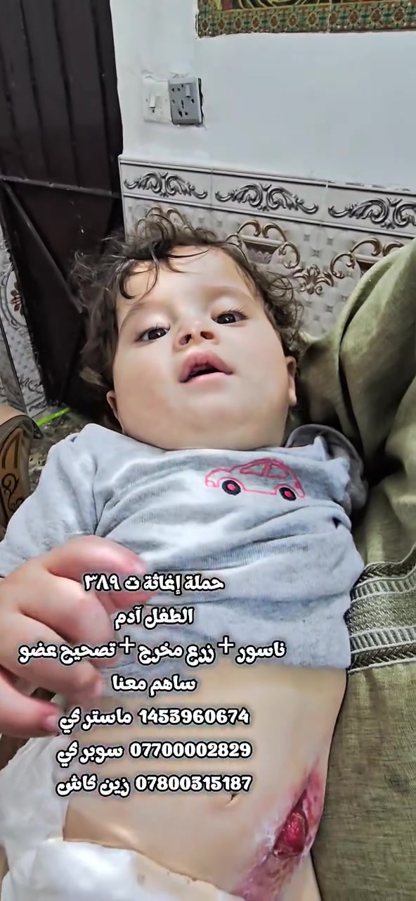 #مناااااشدة_إنسانية_لإصحاب_القلوب_الجميلة_والرحيمة
#حالة_ت_٣٨٩_تم_نشرها_بتأريخ ٦/٧/٢٠٢٦
من ذا الذي يقرض الله قرضآ حسنآ فيضاعفه له أضعافآ كثيرآ

الملاك البرئ 🐣 آدم 🐣 من بغداد الكرخ يحتاج الى عملية ناسور + تصحيح عضو + زراعة مخرج + علاجات ومتابعة...والد الطفل كاسب يشتغل بمطعم والام ربة بيت ويسكنون إيجار في مشاحة ٥٠ متر فقط والحياة صعبة علبهم والظروف واقعية جدآ وأمام أنظاري ظرفهم التعبان جدآ والمؤلم بنفس الوقت ...ننتظر تبرعاتكم ودعمكم والله ولي التوفيق لكم جميعآ 

إذا حبيت تتصدق  للحالة اللي شفتهه أو أي حالة 👇
*********** 👈نستقبل صدقتك سوبركي 
*********** 👈نستقبل صدقتك زين كاش 
  1453960674 👈نستقبل صدقتك ماستر كي
  بإسم محمد رزاق 

🔰ملاحظه مهمه جدآ🔰
يمنع منعآ باتآ التجاوز على أي فئة في المجتمع داخل التعليقات
سياسية/دينية/طبية/إعلاميه/شخصية/إفتاءات إجتهاديه/كلام ليس به فائدة للطفل وخارج المطلوب من جنابكم المحترم داخل المنشور (يتم الحظر مباااااااشر)
عملنا إنساني ونتعاون بيناتنه لقضاء حاجه الناس ونبتعد عن الكلام الذي لايقدم ولا يؤخر لي شيئآ.....

نسأل الله ان يعلي مقامكم في الدنيا والآخرة وأن يضاعف الارزاق لكم وأن يبيض وجوهنا أمامكم وأن يبرد صدوركم على فراق الأحبه والغوالي وأن يرحمنا ويرحمكم يوم الورود إن الله سميع لذلك مجيب
