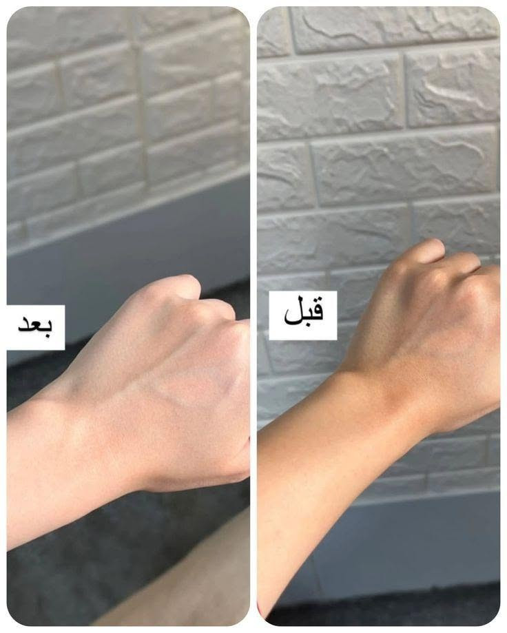✨ مكونات بكج Veloura وفوائدها:
🤎 زبدة الكاكاو
تساعد على ترطيب البشرة بعمق، تمنحها نعومة وتحافظ على مرونتها.
🤍 زبدة الشيا
تغذي البشرة وتخفف الجفاف والخشونة وتمنح ملمساً حريرياً.
🌰 زيت اللوز الحلو
يساعد على توحيد مظهر البشرة ويمنحها نعومة وإشراقة طبيعية.
🥥 زيت جوز الهند
يرطب البشرة ويحافظ على نضارتها ويمنحها مظهراً صحياً.
🌹 الزيوت الطبيعية
تساعد على تغذية البشرة وتحسين ملمسها ومنحها ترطيباً يدوم لفترة أطول.
🧼 المقشر
يزيل الجلد الميت والشوائب ليترك البشرة أنعم وأكثر إشراقاً.
🫧 الصابونة
تنظف البشرة بلطف وتساعد على التخلص من الأوساخ والدهون المتراكمة.
💧 المرطب
يحافظ على رطوبة البشرة ويمنحها نعومة وانتعاشاً طوال اليوم.
✨ النتيجة: بشرة أنعم، أنظف، وأكثر نضارة مع الاستخدام المنتظم. بغداد, العراق


**إذا كنت صاحب هذا الإعلان وتريد حذفه لأي سبب، رجاءا أرسل رسالة إلى الدعم الفني**