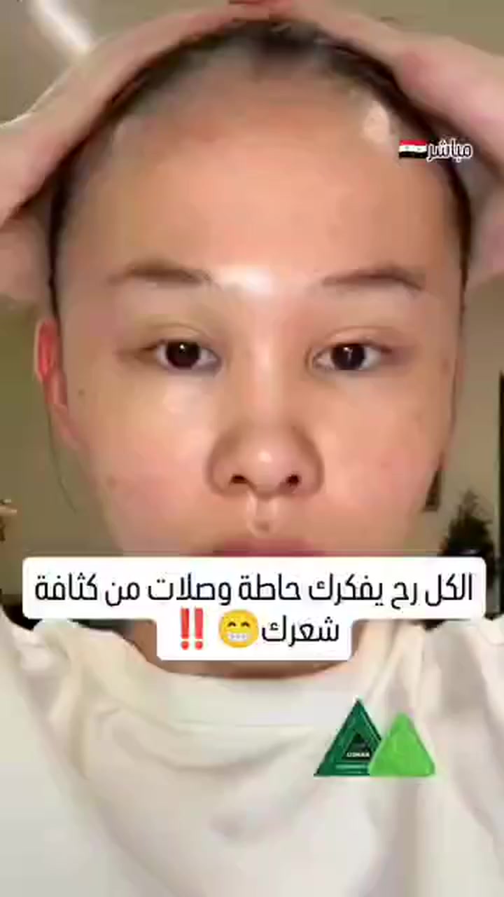 اخيرااا علاج التساقط النهائي صار عنا بسوريا 😁💚🇸🇾 
  صابونة شامبو صلبة عشبية تعتمد على خلاصة أوراق الإيزاتيس Isatis Indigotica والأعشاب الصينية التقليدية ‼️
 "لتقليل تساقط الشعر ، تنشيط الدورة الدموية في فروة الرأس، موازنة إفراز الدهون ، تقليل القشرة والحكة ، تعزيز نمو شعر صحي وقوي، مناسبة للرجال والنساء ولكل أنواع الشعر وخاصة الشعر الضعيف والمتعب🍀 

🛑توصيل مجاني داخل سوريا🛑
#trending #explorepage #reelsinstagram #viral


**إذا كنت صاحب هذا الإعلان وتريد حذفه لأي سبب، رجاءا أرسل رسالة إلى الدعم الفني**