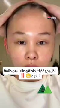 علاج التساقط • صابونة شامبو • إيزاتيس