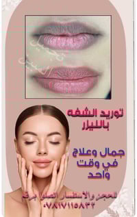 توريد الشفه باحدث طرق العلمية والطبية  للحجز والاستفسار اتصلوا برقم ٠٧...