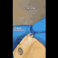 كيفية تعويض الاسنان المفقودة بدون زراعة.

عيادة د.عمار عزيز لطيف 👨‍⚕️💗
بغداد / رحمانية الشعله / عمارة الوليد 
للإستفسار الاتصال على 
***********
***********
