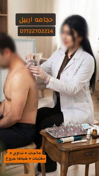 حجامة معقمة • اربيل • صداع وآلام