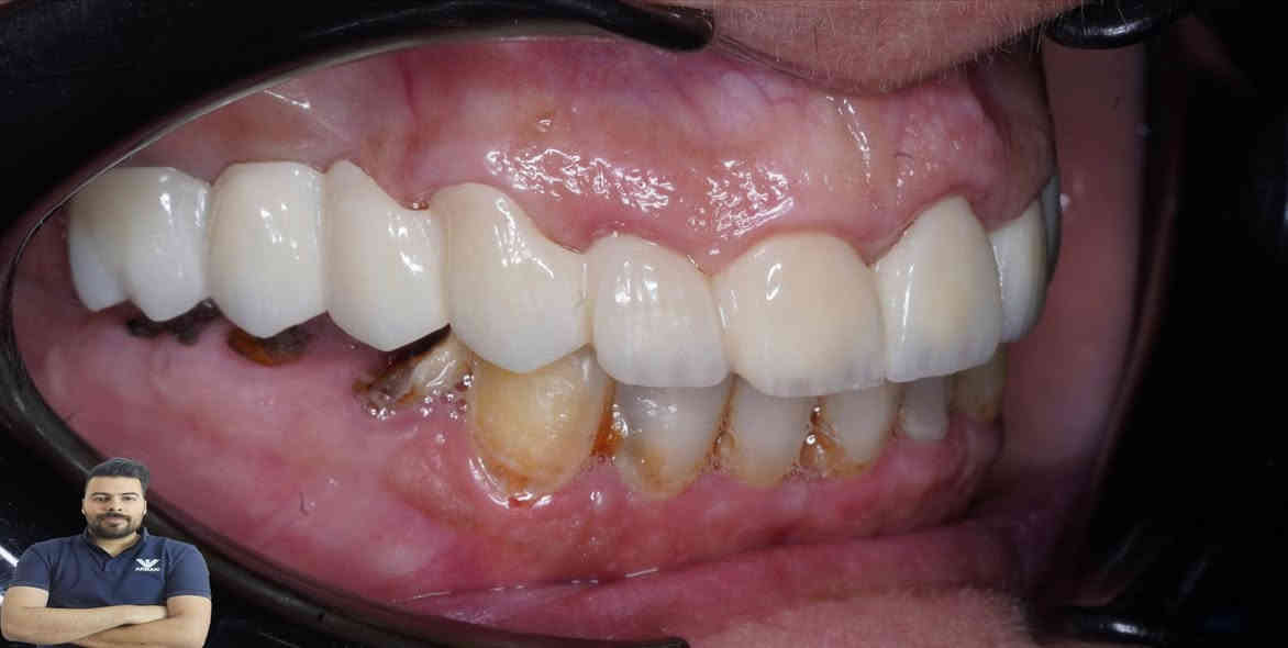 المراجعة مسوية تركيب بغير عيادة وماعاجبهة الشغل اجتي عادتة يمنة وكانت هاية النتيجة

العنوان / المسيب / شارع البلدية / مقابل دكتور جعفر وفي للاطفال/مجاور عالم الحليب

للحجز والاستفسار
***********
***********
