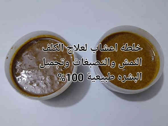 أصبحت الاجواءممتازة لتجميل البشرة اغتنم الفرصة  لبشرة مليئة بالنضارة والجمال🌺🌸 وبشرة صافية كما عودناكم وفرنا لكم مجموعة من خلطات للبشرة 💝مكونة من مواد عشبية وطبيعية☘️🍀 وصحية للبشرة تعمل على إزالة الكلف والنمش والتصبغات والتصبغات العميقة وحب الشباب مجربة وفعالة وراح اذكر لكم تجارب الزبائن🤩🤩 ويتوفر خلطات خاصة بحب الشباب
تتوفر خدمة توصيل جميع المحافظات 🚗🚗***********
