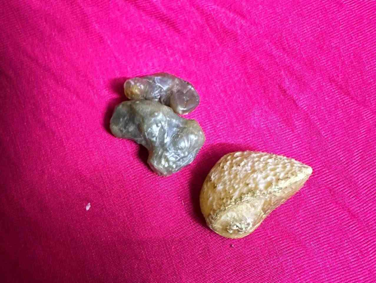 السلام عليكم عندي هذي الاحجار للبيع ومتوفر توصيل ( هبهاب ًوعقذ لسان وزوعة الحية


**إذا كنت صاحب هذا الإعلان وتريد حذفه لأي سبب، رجاءا أرسل رسالة إلى الدعم الفني**