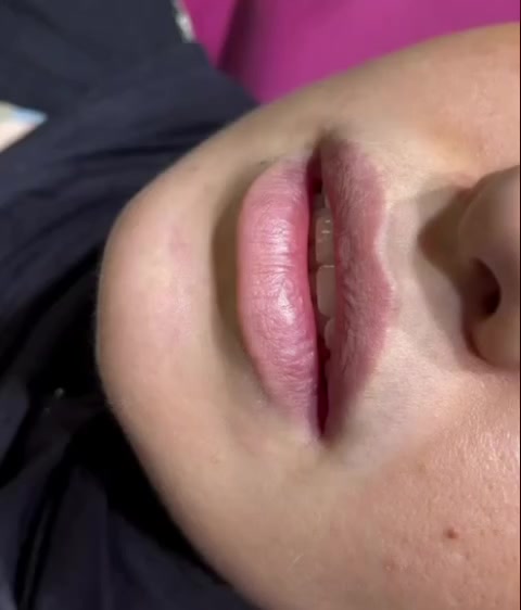 فلر شفه أبتك 
كوري 1 سيسي سعر 50 الف 》
#فلر_شفايف #تغيير_للأفضل


**إذا كنت صاحب هذا الإعلان وتريد حذفه لأي سبب، رجاءا أرسل رسالة إلى الدعم الفني**