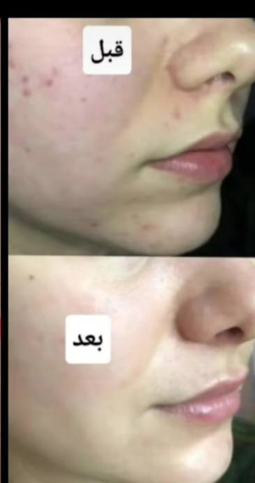 بكج مبيض للبشره والجسم سعر ٣٠ الف


**إذا كنت صاحب هذا الإعلان وتريد حذفه لأي سبب، رجاءا أرسل رسالة إلى الدعم الفني**
