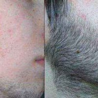 زيت نمو • نمو اللحية • نتيجة سريعة