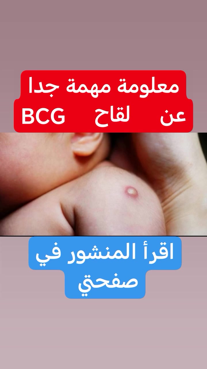 مساء الخير والعافيه 

موضوع اليوم 

 خراج لقاح الكتف  او لقاح التدرن 

موضوع هواي اهالي يسالوني علية 
او يراسلوني 

انو طفلهم  منطقة اللقاح بيهة جراحة او خراج  او حمرة 
ويسالوني شون  نتعامل وياهة 

او يسالوني دكتور ابني لقاح الكتف ماطلعت بي علامة

 لقاح  التدرن او السل  الرئوي

👈لقاح يحتوي على سلالة مضعفة من بكتريا السل 

👈ينطي حماية من التدرن  تجاوز  ال ٨٠% بالمية 

👈بالعادة يترك اثر بالكتف  بعد  مرور شهرين او ثلاث على اللقاح 

👈مكان اللقاح  بالكتف الايسر  

👈اللقاح ينطي اول اسبوع بعد الولادة 

 خراج او التهاب لقاح السل 

بعد اللقاح  بفترة   تظهر منطقة اللقاح بشكل احمر  وتنتفخ    

بعض  الحالات  يصير  خراج    وتكوم تذب جراحة  وتخوف الاهل 

 الوقاية والتعامل مع خراج  لقاح التدرن

اولا   
شفتو اللقاح بي جراحة او احمر ومنفوخ تجون طبيب الاطفال يتاكد  نتيجة اللقاح  ومو بسبب شي اخر 

ثانيا 
ممنوع  منعا  باتا  تعصرون الجراحة وحتى الجرح
وديرو بالكم لان راح  تلوصون الوضعية 

ثالثا  
تغطية اللقاح بالشاش الطبي  خاصة اذا يذب سوائل وخراج

رابعا
تنظيف مكان اللقاح  والاستحمام بشكل طبيعي حتى مكان الجرح    تكدرون   تمسحو  حالة حالة الجسم 

خامسا
اذا انفجر عدكم جيس الخراج  نظفو  بالشاش والماء الدافي   او الصابون 

سادسا
كمادات دافية يوميا    ٣ او ٤ مرات باليوم 

سابعا 
تنظيف المكان بالكحول الطبي مرة عالاقل   وبعدها مسح المكان وتركهة للهواء ليجف

ثامنا 
الحالات الشديدة تستدعي تداخل جراحة ورفع الخراج والجلد الملتهب حوله  واعطاء المضادات  الحيوية

 ملاحظة مهمة 

👈مرات  يتاخر ظهور ندبة  اللقاح  الى ٦  اشهر من عمر الطفل 

👈عدم ظهور ندبة مو يعني  فشل اللقاح  

دمتم واطفالكم بألف خير

الدكتور
احمد محمود عبدالله
طبيب الأطفال والخدج وحديثي الولادة

العنوان
بغداد حي الحسين مجمع التقى الطبي قرب مجمع النمور مقابل كوزمتك الفرج 

للحجز والاستفسار
***********
