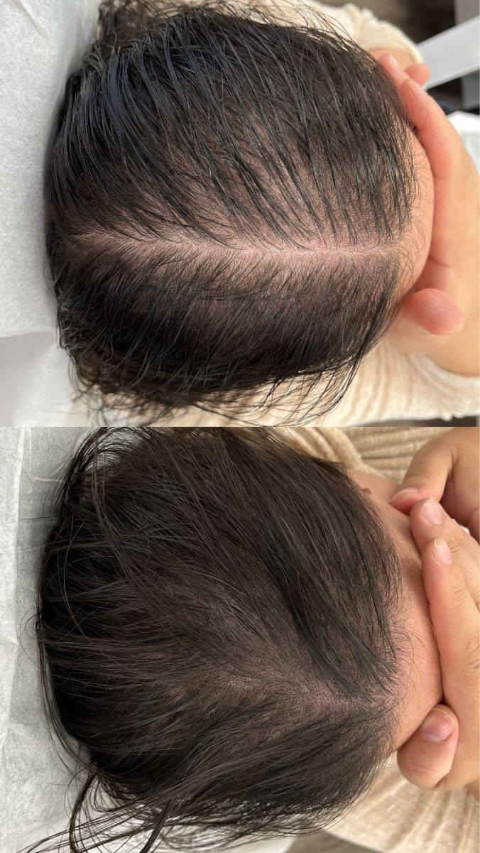 💖💆‍♀️ تعبتي من تساقط الشعر؟

زيت سحر  الحل الطبيعي اللي شعرك محتاجه!
بتركيبة غنية بالزيوت الطبيعية، يساعد على تقوية الجذور، تقليل التساقط، وتحفيز نمو شعر صحي وكثيف 🌿✨
جربيه اليوم، وخلي شعرك يتنفس من جديد 💛
#زيت_سحر  #تساقط_الشعر #عناية_طبيعية #شعر_قوي


**إذا كنت صاحب هذا الإعلان وتريد حذفه لأي سبب، رجاءا أرسل رسالة إلى الدعم الفني**