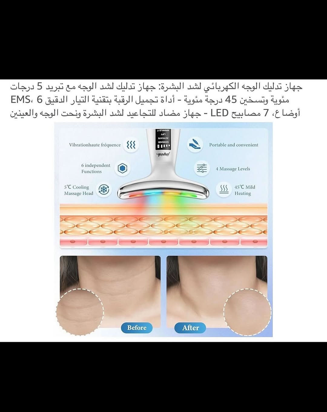 جهـاز تدليك وشد وحرارة الوجـه واسفل العين والرقبة شحن محمـول 
شحن (تايبسي) نظام متطـور وحديث مع قاعدة شحن منضدية 
تسخين تلقائي عند (45) درجة مئوية مضاد للتجاعيد والشيخوخة 
جهـاز يعمل على شد جلد الوجه والعين والرقبة 
جهـاز تدليك لشد الوجه مع تبريد (5) درجات مئوية 
اداة تجميل الرقبة بتقنية التيار الدقيق (6) اوضاع (EMS) 
يتضمن (7) مصابيح لكل ضوء خاصية لمعالجة مشاكل البشرة 
يجمع جهاز شد البشرة بين التيار الدقيق للتحفيز الكهربائي للعضلات والاهتزازات الصوتية بسرعة (10000) دورة في الدقيقة لتنشيط عضلات الوجه 
رأس تدليك عالي (EMS) اهتزاز عالي التردد 
تصميم مريح لتنحيف الوجه هندسياً ليناسب منحنيات الرقبة والوجه والفكين والذراعين 
نظـام عمل تلقائي عند ملامسة البشرة 
جديد بالباكيت مع الملحق 
للتفاصيل اكثر داخل الموقع الرسمي 
السعـر ١٦ آلاف 💰
ملاحظة (عند الشراء فحص المنتج قبل مغادرة المندوب بعدها نكون غير مسؤولين)
توصـيل 🚚 بغداد ٥ آلاف 
توصـيل 🚚 محافظات ٦ آلاف⁩


**إذا كنت صاحب هذا الإعلان وتريد حذفه لأي سبب، رجاءا أرسل رسالة إلى الدعم الفني**
