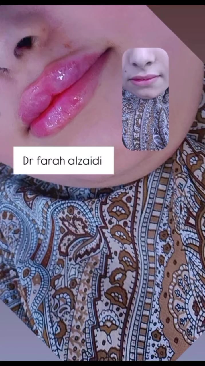 مثل ما عودناكم على شغلنا الراقي ❤️🌹

عيادة البيان 
الدكتورة فرح الزيدي 

الغراف/ مقابل مدرسة السجاد الابتدائية 
مجاور صيدلية مدينتي 
داخل مجمع الابرار الطبي


**إذا كنت صاحب هذا الإعلان وتريد حذفه لأي سبب، رجاءا أرسل رسالة إلى الدعم الفني**