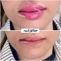 فلر شفه • حسب الطلب • كل الماركات