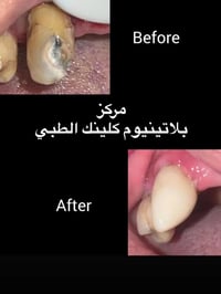 بلاتينيوم كلينك • مركز طبي • المحمودية حي 17